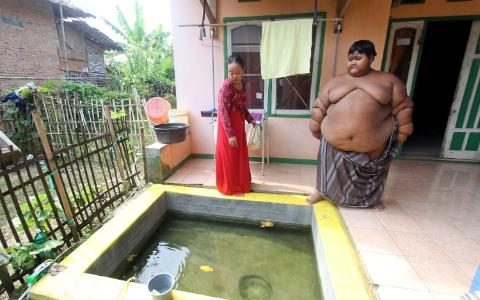 101977375_PIC_FROM_SIJORI_IMAGES-CATERS_NEWS_-_PICTURED_Arya_Permana_10-years-old_is_a_giant_boy_fro-medium_trans++qVzuuqpFlyLIwiB6NTmJwdLT20HJxwNums8pePv7OhU