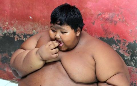 101977377_PIC_FROM_SIJORI_IMAGES-CATERS_NEWS_-_PICTURED_Arya_Permana_10-years-old_is_a_giant_boy_fro-medium_trans++x8uPMxZ34cZWnis1wGnZx0hg39-7cKkM9yxusTYYcOw