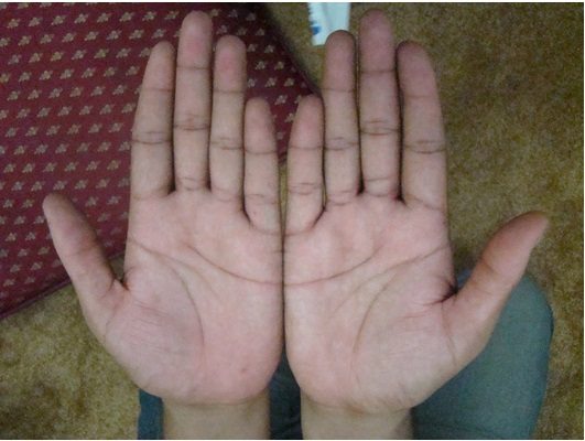 palm2