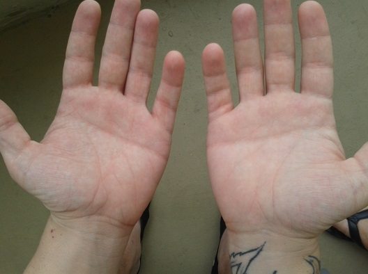 palm3