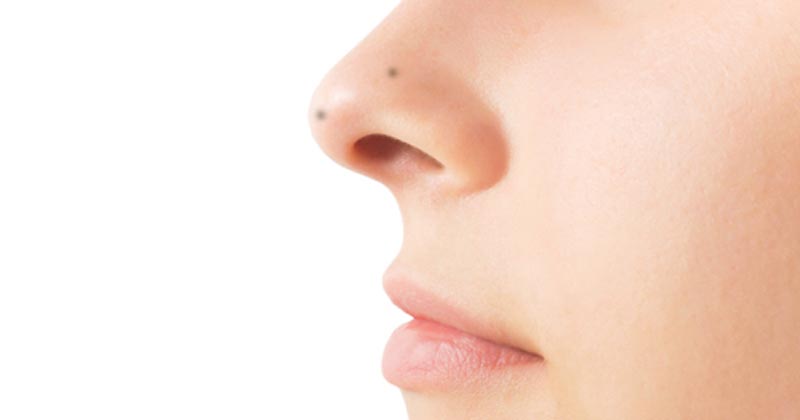 your body mole tells about your personality