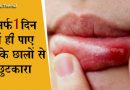 मुँह के छालों से हैं परेशान तो अपनाएँ ये घरेलू नुस्खे, एक ही दिन में ठीक हो जायेंगे छाले मुँह के छालों से हैं परेशान तो अपनाएँ ये घरेलू नुस्खे, एक ही दिन में ठीक हो जायेंगे छाले