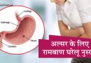 पेट के अल्सर के लिए रामबाण इलाज हैं ये घरेलू नुस्खे, एकबार आजमायें जरुर दिखेगा फायदा पेट के अल्सर के लिए रामबाण इलाज हैं ये घरेलू नुस्खे, एकबार आजमायें जरुर दिखेगा फायदा