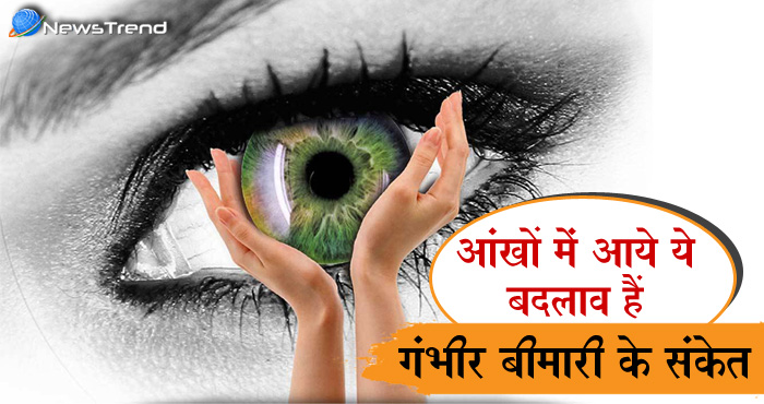 आंखों में नज़र आए ये 7 चेंजेज़ तो हो जाएं सावधान, हो सकती है गंभीर बीमारी