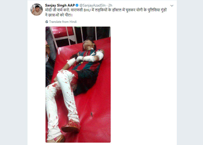 Viral photo of wounded girl from bhu