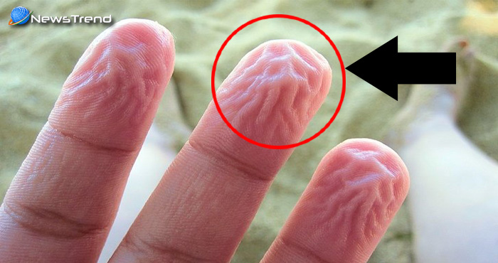 skin wrinkles, क्या आपकी उंगलियों का भी होता है यह हाल? यदि हां, तो ज़रूर पढ़ें यह खबर