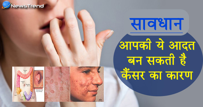 नाखून चबाना हो सकता है जानलेवा, जान लेंगे तो आज ही छोड़ देंगे यह आदत