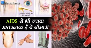 यह बीमारी है एड्स से भी ज्यादा खतरनाक, ये 6 लक्षण दिखने पर तुरंत जाकर डॉक्टर से मिलें