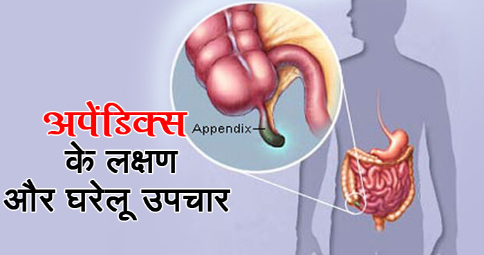 अपेंडिक्स के लक्षणों की इस तरह से करें पहचान, इस रोग से मुक्ति पानें के लिए अपनाएं ये घरेलू तरीके