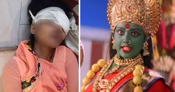 लड़की न चढ़ाई अपनी आँख, लड़की ने उँगलियों से आँख निकालकर चढ़ा दी देवी माँ को