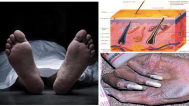 मौत के बाद भी बढ़ते हैं बाल और नाखून, वजह जानकर आप यकीन नहीं कर पाएंगे
