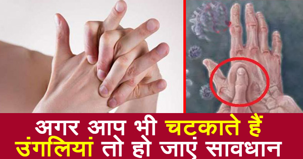 उंगलियां चटकाना, आज से ही छोड़ देंगे अँगुलियों को चटकाना