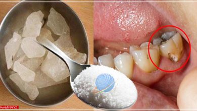 teeth worms remedy