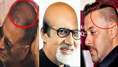 आपके चहेते बॉलीवुड स्टार्स हैं गंजे, नकली बालों का करते हैं इस्तेमाल, नंबर 3 से शायद आप भी है अनजान