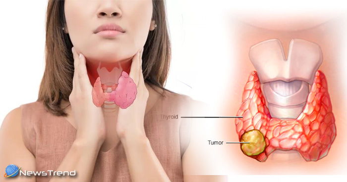 अपने घर पर इस तरह से पता करें, कहीं आप थायराइड के शिकार तो नहीं?