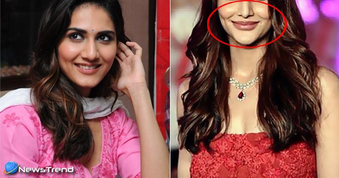 before and after photos of Vaani Kapoor which proves lips surgery a disaster