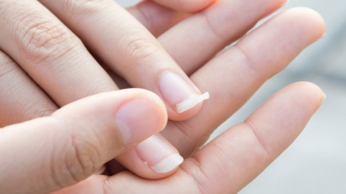 nail