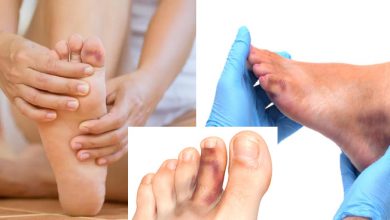 डॉक्टर की चेतावनी: यदि आपके पैरों में भी हैं ऐसे निशान तो हो सकता हैं कोरोना