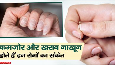 weak nails