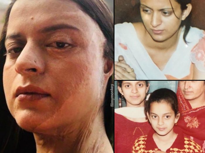 kangana ranaut sister rangoli acid attack