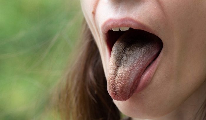 tongue