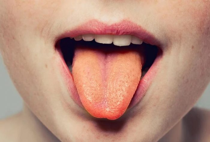 tongue