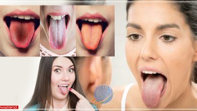 tongue colour