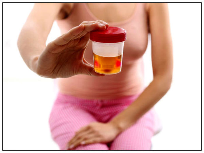 urinary tract infection