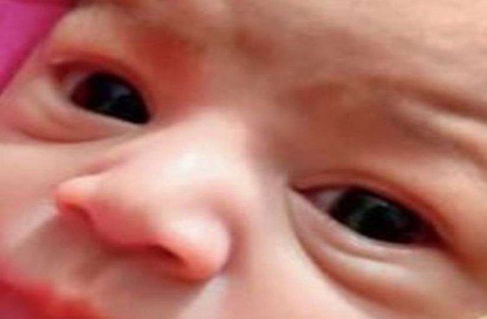 eye