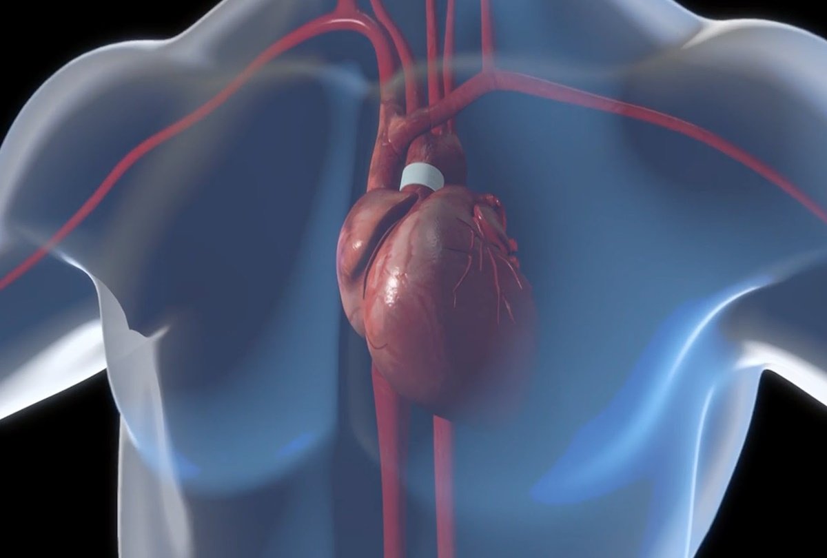 heart