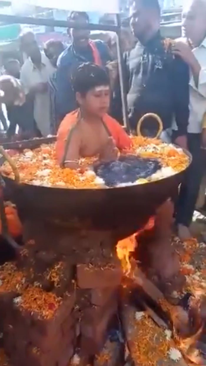boy-sitting-in-boiling-water-went-viral