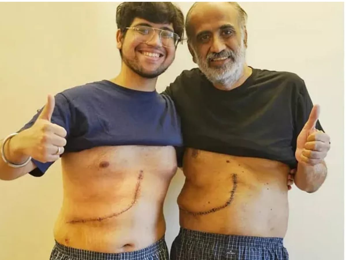 Son donate Liver to save his father