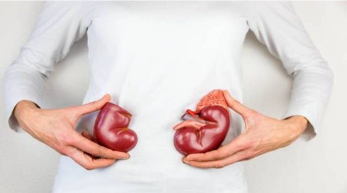 Pig kidney transplant into human