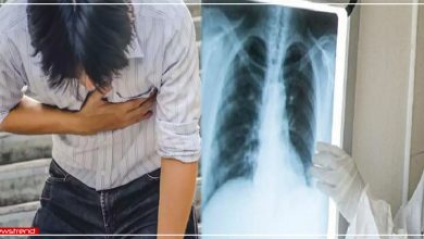 chest-pain-had-chest-pain-doctor-found-strange-object-near-heart