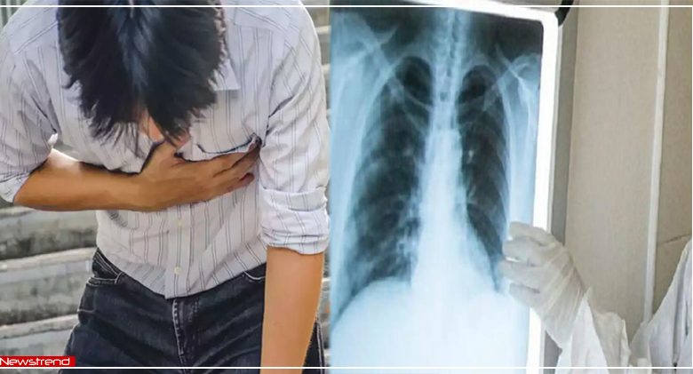 chest-pain-had-chest-pain-doctor-found-strange-object-near-heart