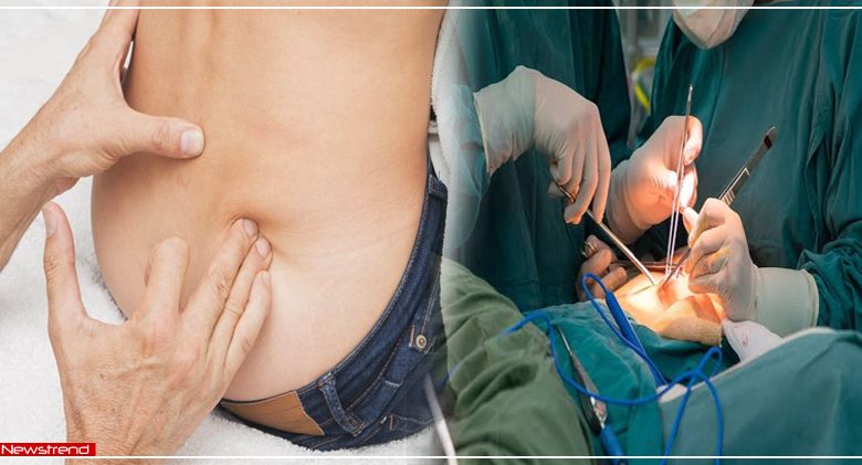doctor removed kidney during the stone operation