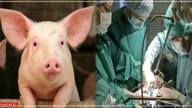 doctors-succeeded-in-transplanting-pig-kidney-to-human