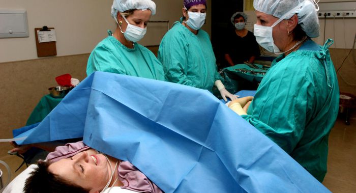 Cesarean Delivery